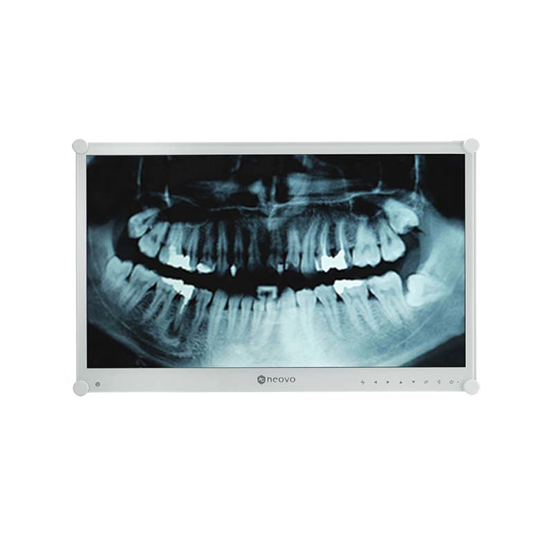 Neovo DR-24G Dental Monitor, 23.5inch, FHD 1920x1080, 250cd/m2, 20.000:1, 3ms (GTG) - Afbeelding 4