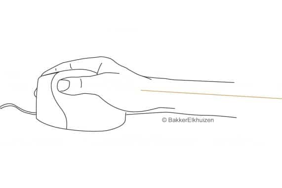 BakkerElkhuizen Evoluent 4 Small