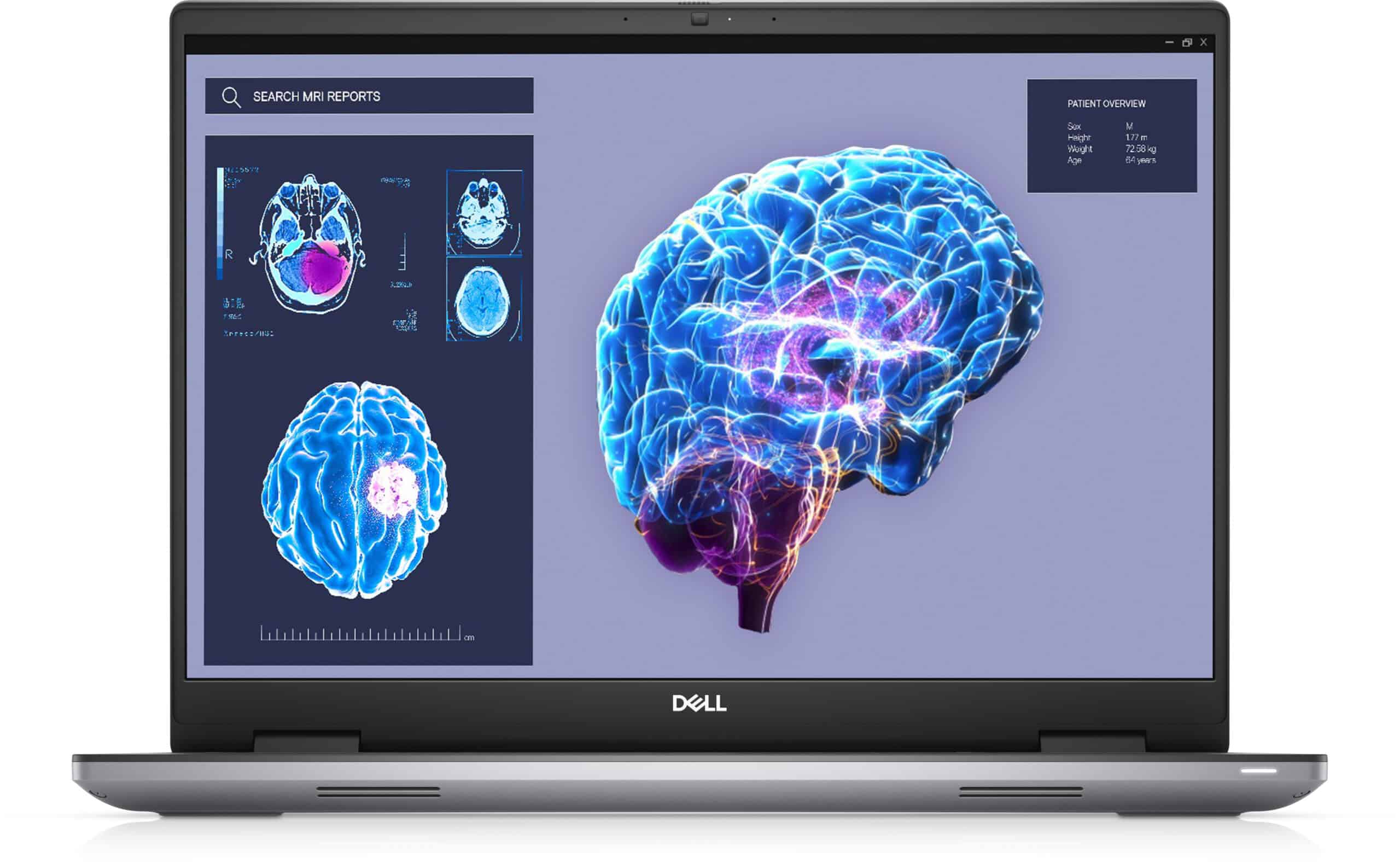 DELL Precision 7680 Intel Core i7-13850HX Mobiel werkstation 40,6 cm (16") Full HD+ 32 GB DDR5-SDRAM 1 TB SSD NVIDIA RTX 2000 Ada Wi-Fi 6E (802.11ax) Windows 11 Pro Belgisch Grijs