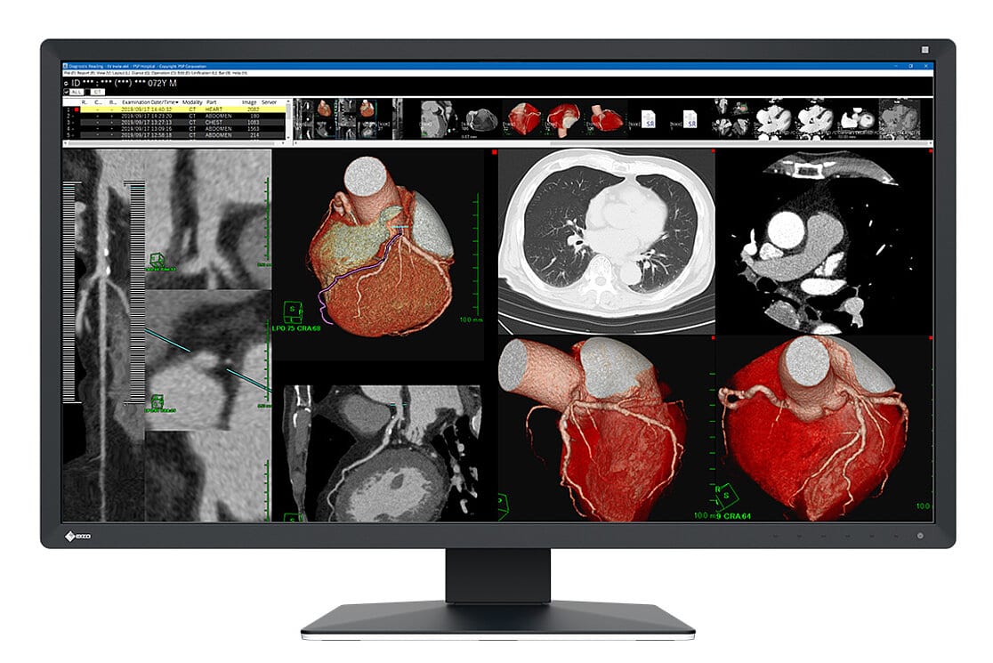 EIZO RadiForce MX317W computer monitor 77,5 cm (30.5") 4096 x 2160 Pixels 4K DCI LCD Zwart