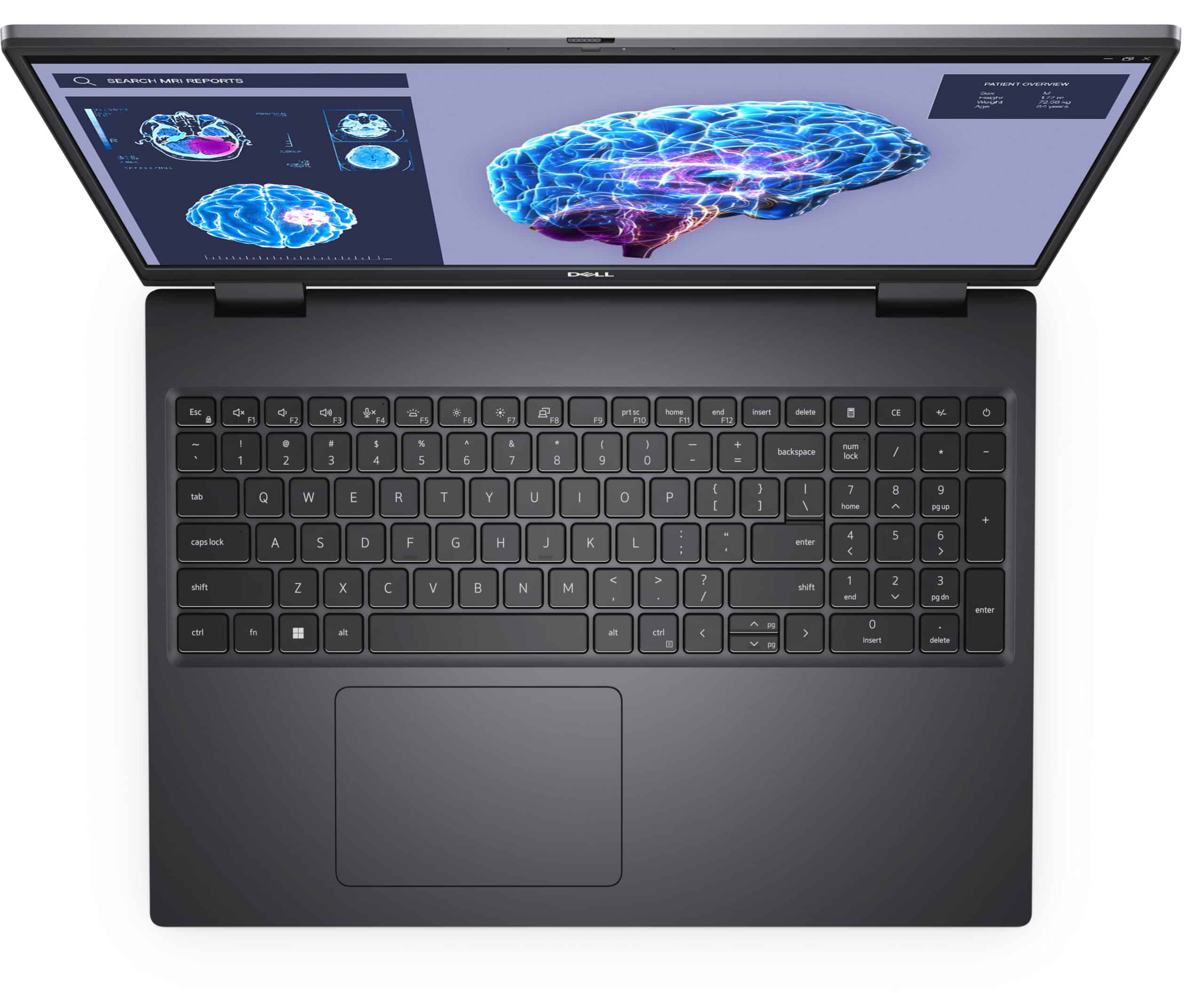 DELL Precision 7680 Intel Core i7-13850HX Mobiel werkstation 40,6 cm (16") Full HD+ 32 GB DDR5-SDRAM 1 TB SSD NVIDIA RTX 2000 Ada Wi-Fi 6E (802.11ax) Windows 11 Pro Belgisch Grijs - Afbeelding 4